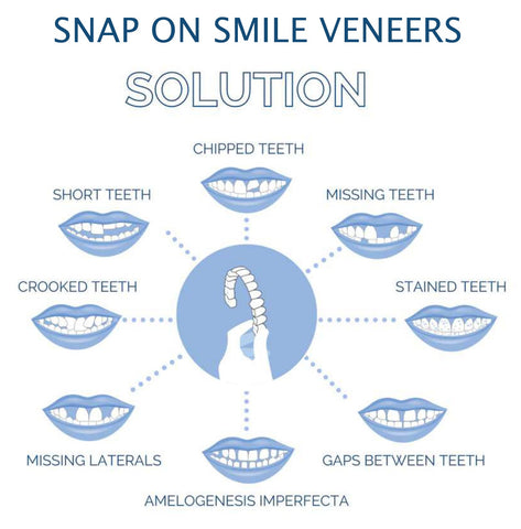 Custom Fit Veneers | Snap-On Solution for Instant Smile Transformation | Comfortable, Durable Design for Flawless Confidence 5