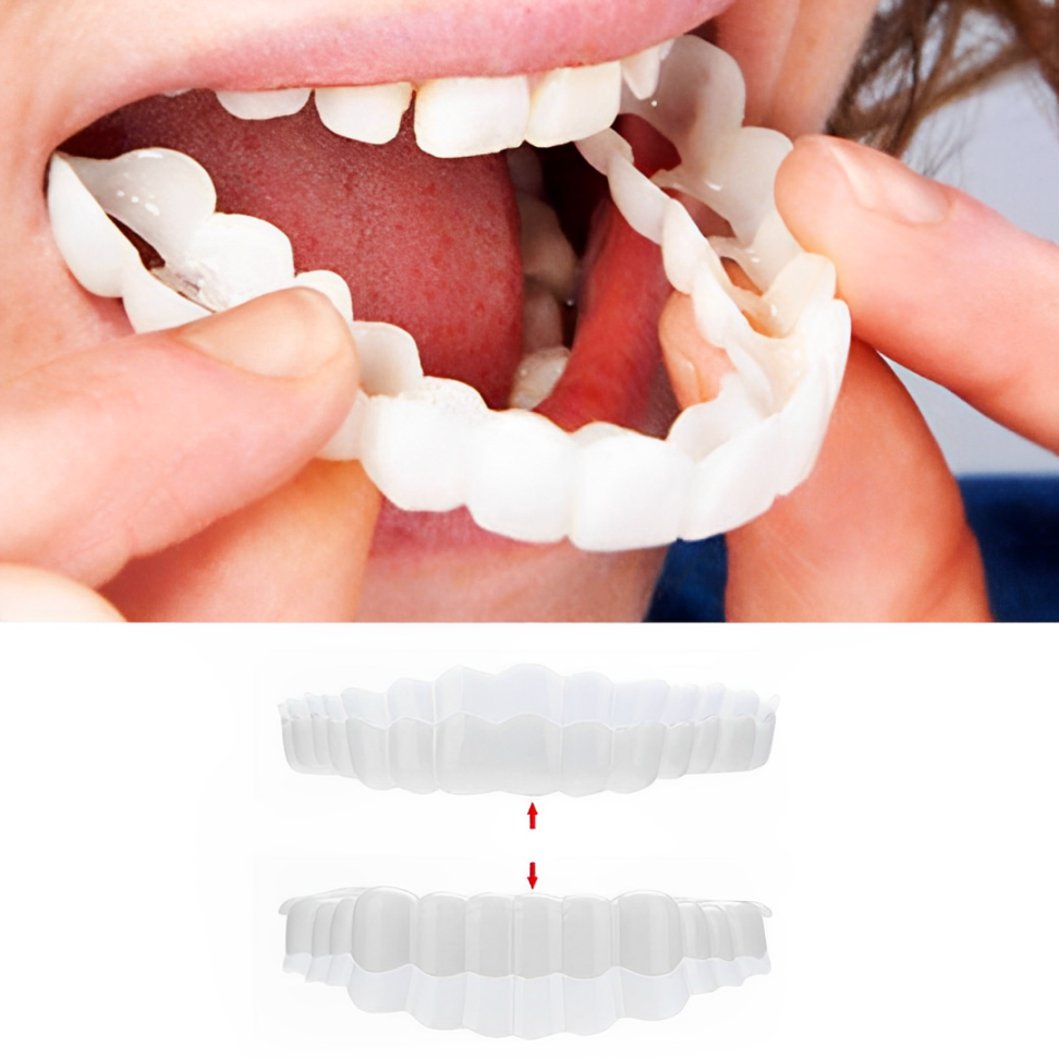 Custom Fit Veneers | Snap-On Solution for Instant Smile Transformation | Comfortable, Durable Design for Flawless Confidence 0