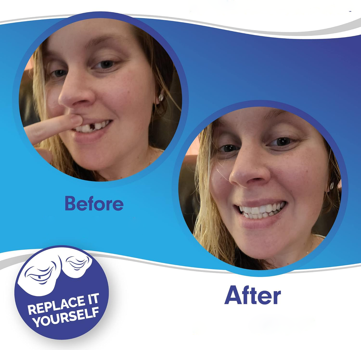 Custom Fit Veneers | Snap-On Solution for Instant Smile Transformation | Comfortable, Durable Design for Flawless Confidence 2